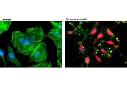 Immunofluorescence Image 1: Cleaved Caspase-3 (Asp175) (D3E9) Rabbit mAb (Alexa Fluor® 594 Conjugate)