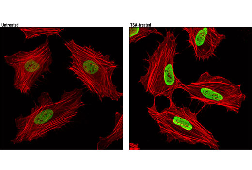 Immunofluorescence Image 1: Acetyl-Histone H3 (Lys27) (D5E4) XP® Rabbit mAb