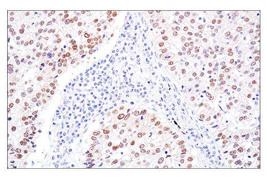 Immunohistochemistry Image 5: MAGE-A10 (E9V2Q) Rabbit mAb