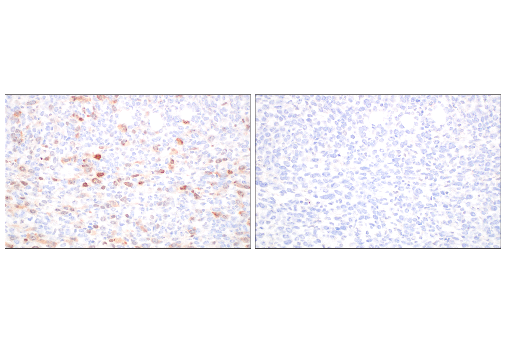 Immunohistochemistry Image 5: Cyclin A2 (E9Q5G) Rabbit mAb