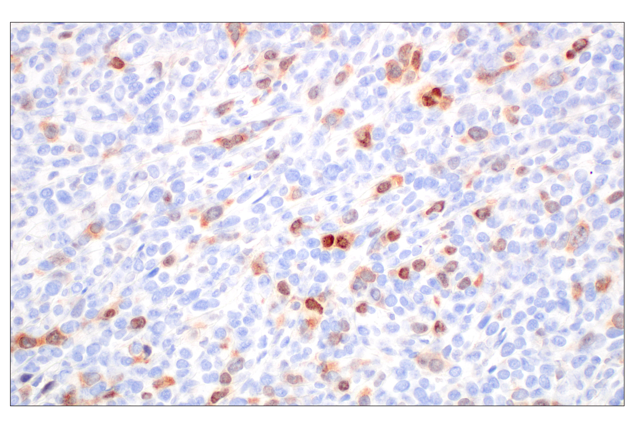 Immunohistochemistry Image 1: Cyclin A2 (E9Q5G) Rabbit mAb