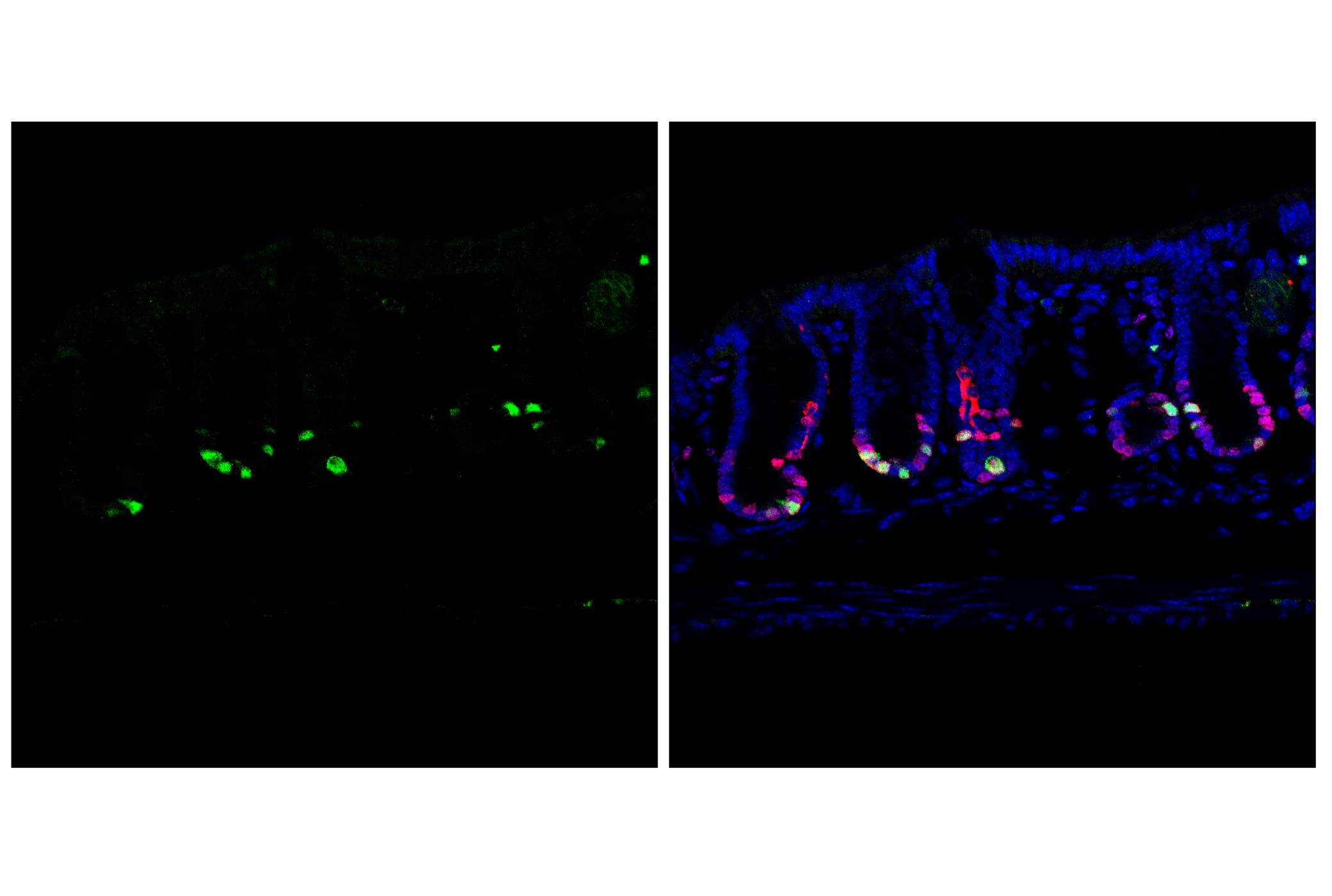 Immunofluorescence Image 2: Cyclin A2 (E9Q5G) Rabbit mAb