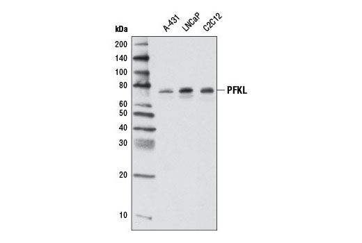 Western Blotting Image 1: PFKL Antibody