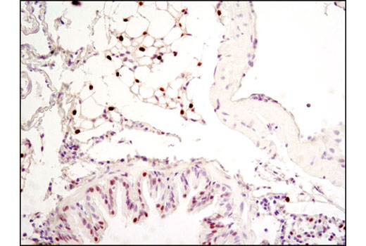  Image 11: Adipogenesis Marker Antibody Sampler Kit