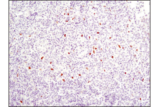 Immunohistochemistry Image 4: C/EBPα (D56F10) XP® Rabbit mAb