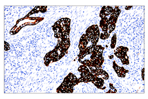 Immunohistochemistry Image 1: Keratin 5 (E2T4B) XP® Rabbit mAb (BSA and Azide Free)