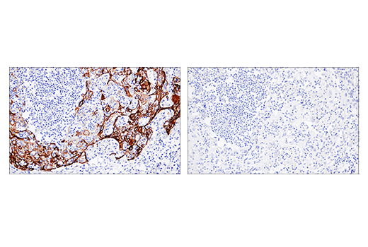 Immunohistochemistry Image 5: Keratin 5 (E2T4B) XP® Rabbit mAb (BSA and Azide Free)