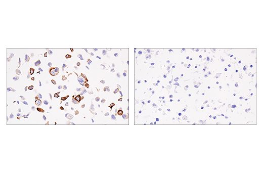 Immunohistochemistry Image 4: Keratin 5 (E2T4B) XP® Rabbit mAb (BSA and Azide Free)