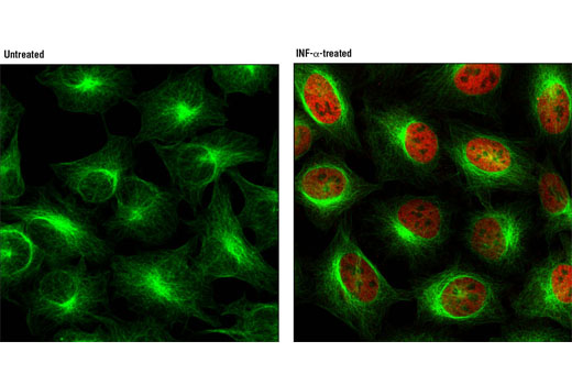 Immunofluorescence Image 1: Phospho-Stat1 (Tyr701) (58D6) Rabbit mAb (Alexa Fluor® 555 Conjugate)