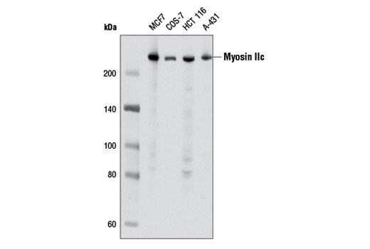 Western Blotting Image 1: Myosin IIc (D4A7) Rabbit mAb