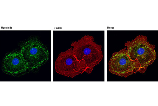 Immunofluorescence Image 1: Myosin IIc (D4A7) Rabbit mAb