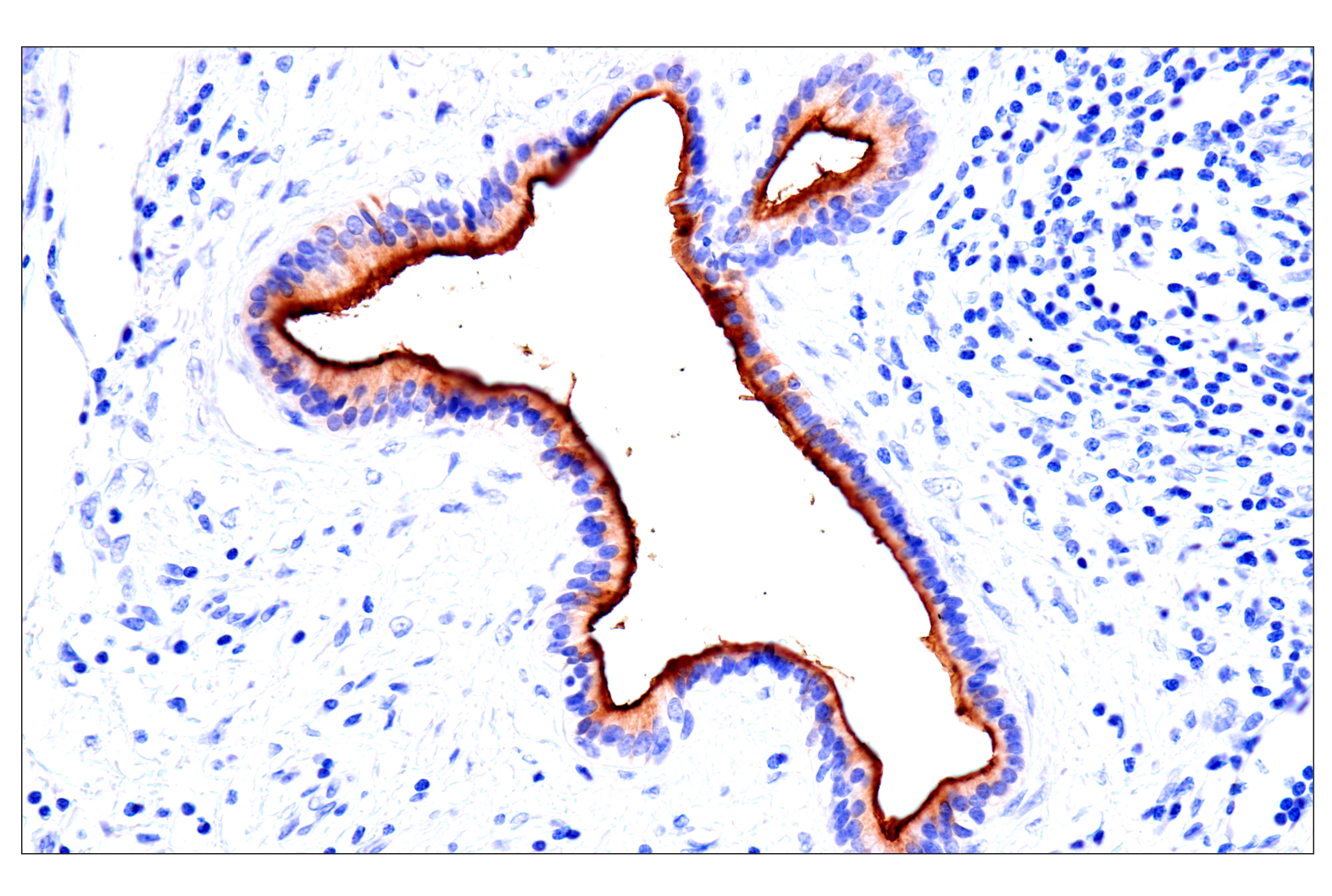 Immunohistochemistry Image 7: CEACAM7 (E5Q6X) Rabbit mAb