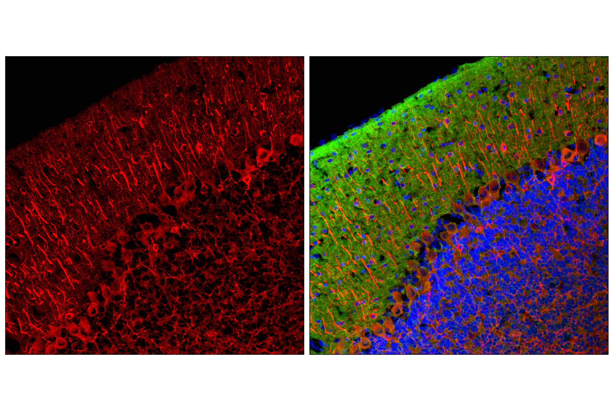 Immunofluorescence Image 1: β3-Tubulin (E9F3E) Mouse mAb (Alexa Fluor® 647 Conjugate)