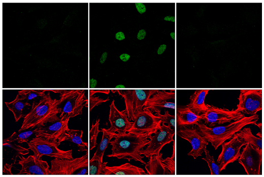 Immunofluorescence Image 1: Phospho-PBRM1/BAF180 (Ser948) (E6Z2C) Rabbit mAb