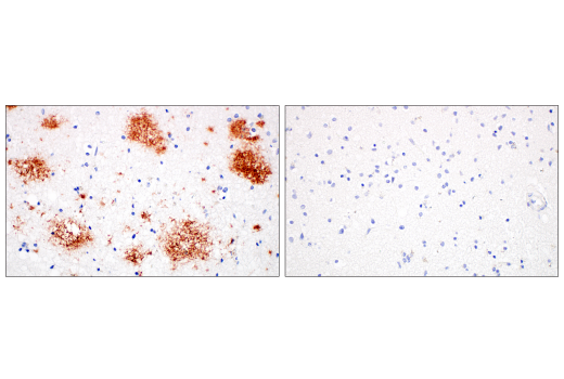 Immunohistochemistry Image 2: β-Amyloid (1-42) (E6D5M) Rabbit mAb (BSA and Azide Free)