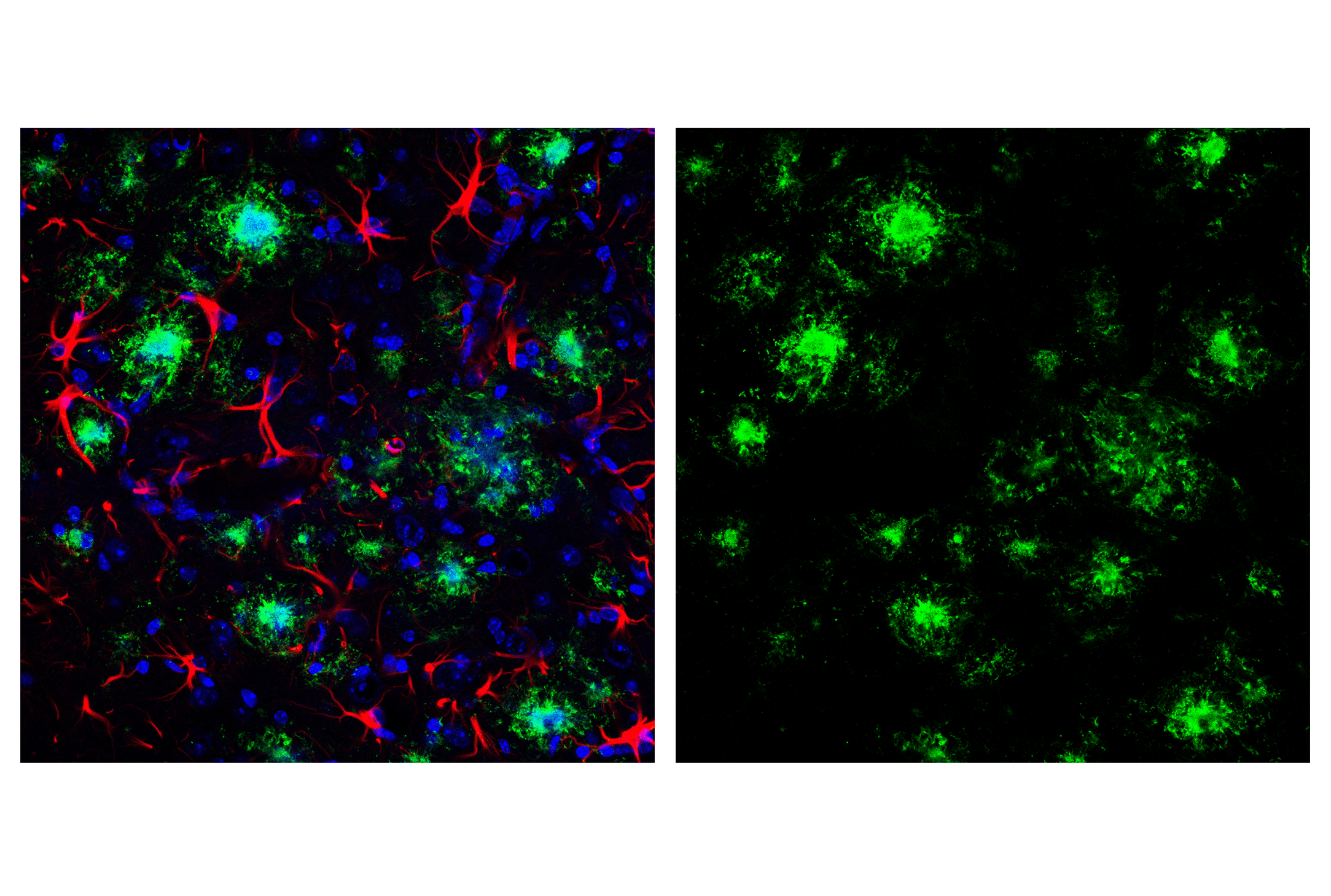 Immunofluorescence Image 1: β-Amyloid (1-42) (E6D5M) Rabbit mAb (BSA and Azide Free)