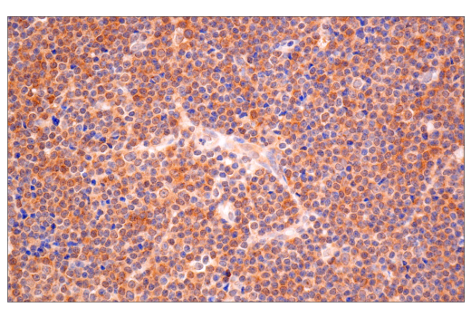 Immunohistochemistry Image 5: VHL (E3X9K) Rabbit mAb (BSA and Azide Free)