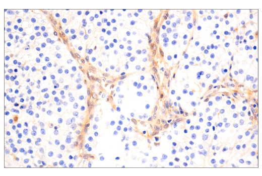 Immunohistochemistry Image 3: VHL (E3X9K) Rabbit mAb (BSA and Azide Free)