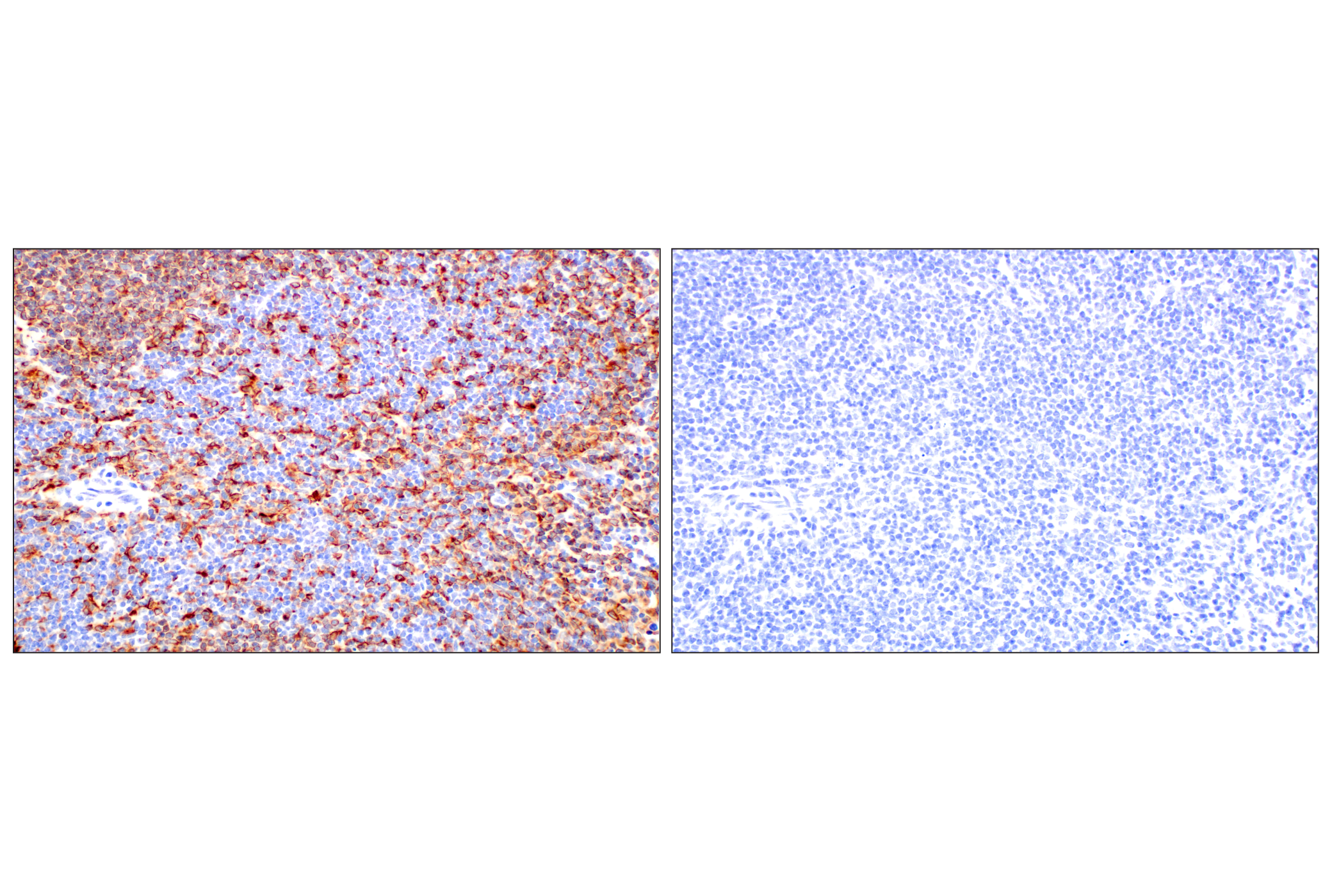 Immunohistochemistry Image 8: CD74 (F3R3L) Rabbit mAb