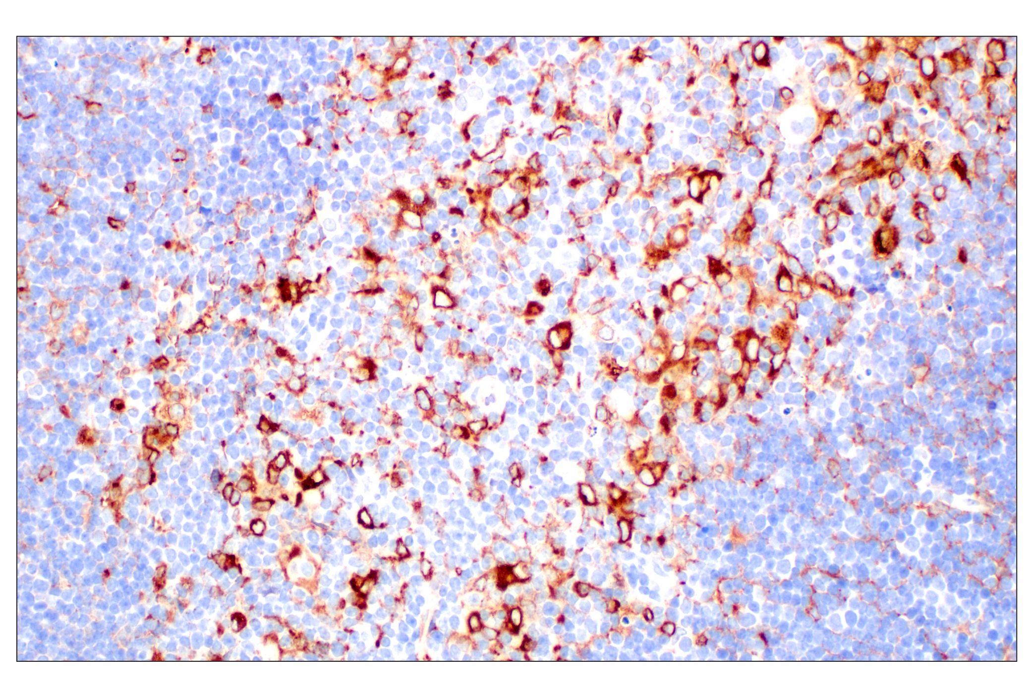 Immunohistochemistry Image 6: CD74 (F3R3L) Rabbit mAb