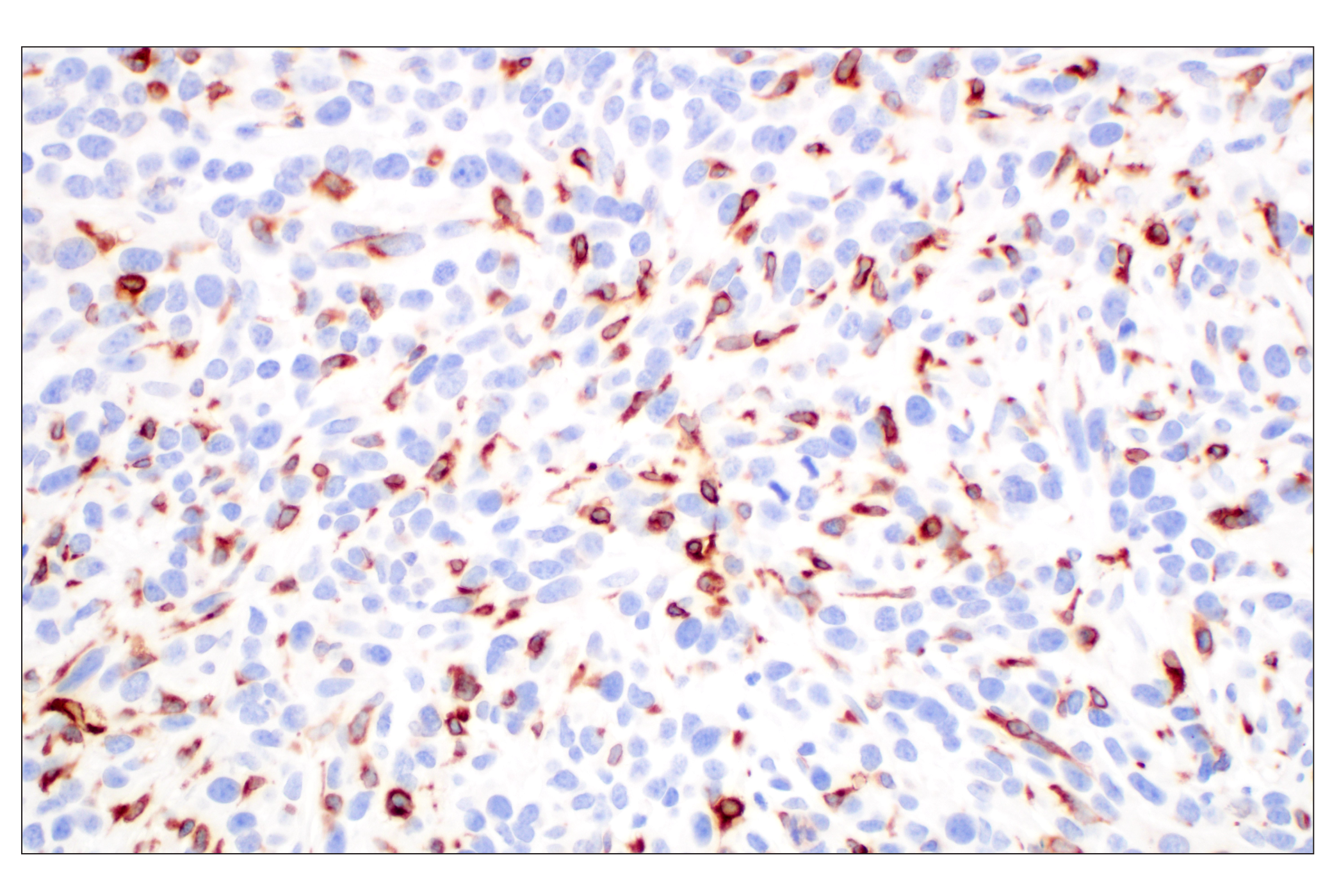Immunohistochemistry Image 2: CD74 (F3R3L) Rabbit mAb