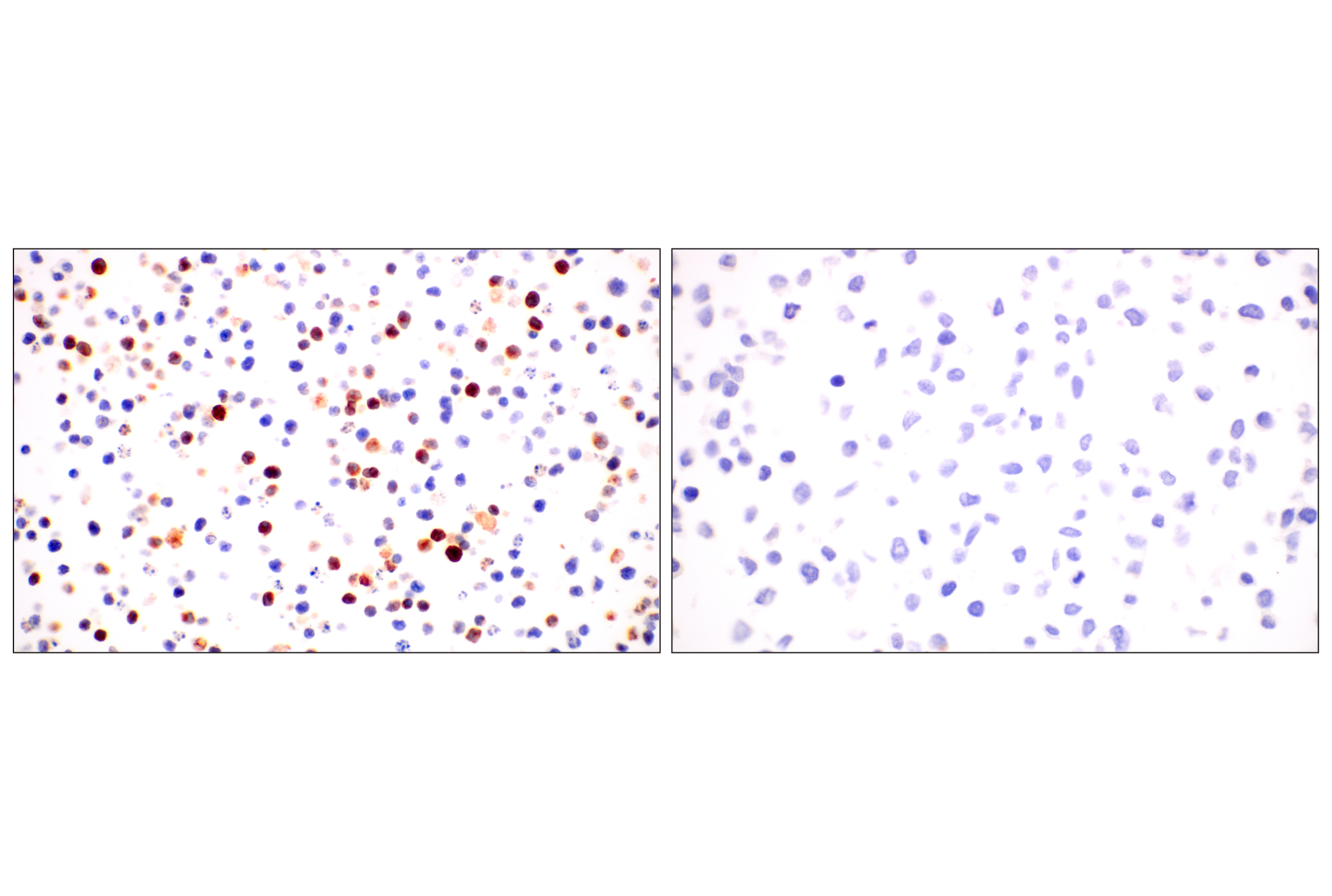 Immunohistochemistry Image 9: CD74 (F3R3L) Rabbit mAb