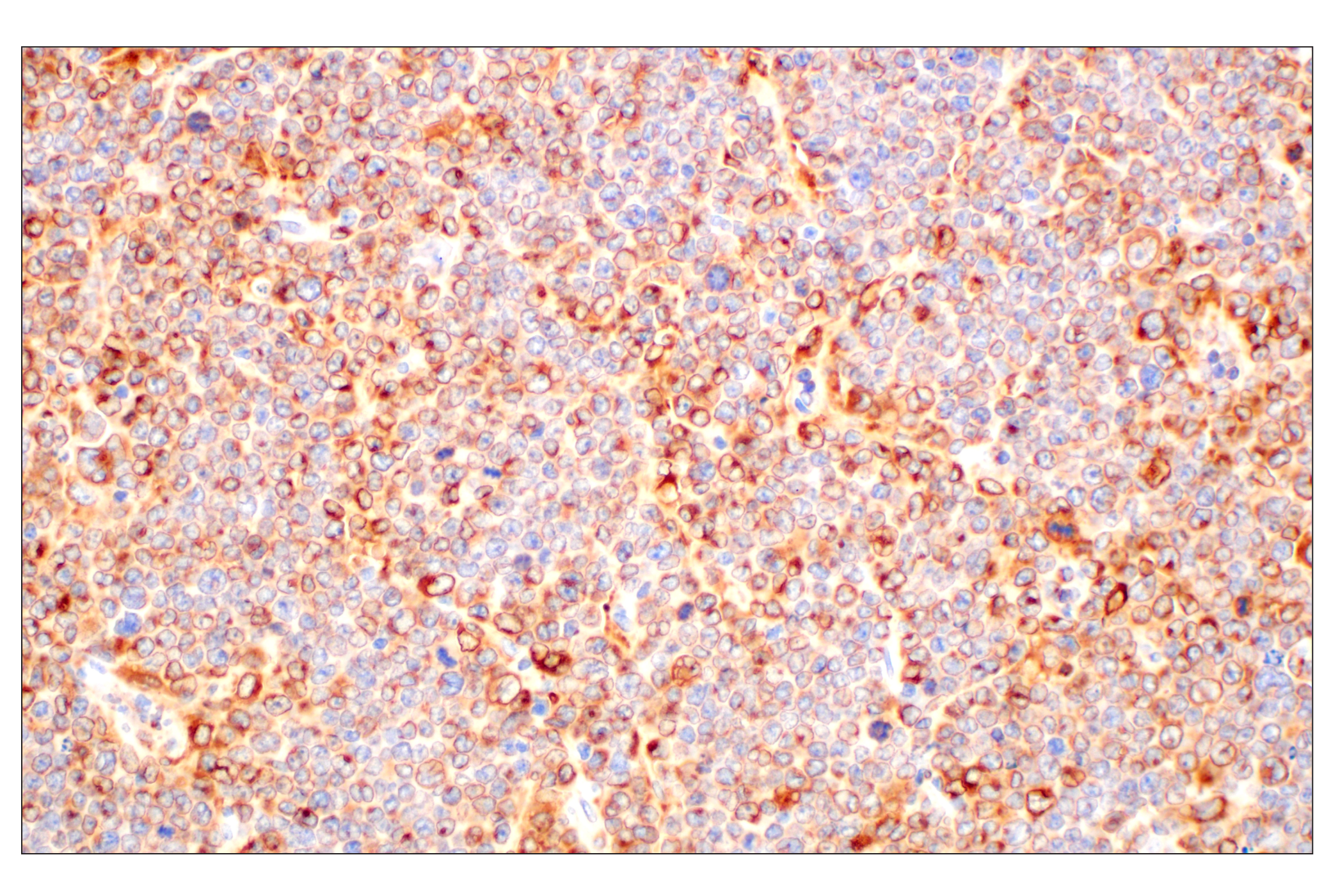 Immunohistochemistry Image 1: CD74 (F3R3L) Rabbit mAb