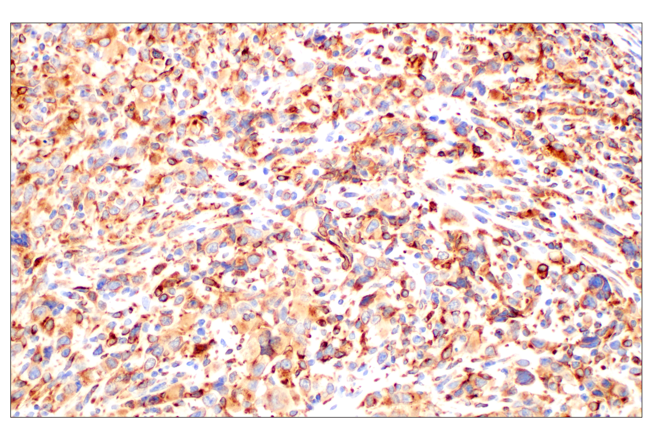 Immunohistochemistry Image 5: CD74 (F3R3L) Rabbit mAb