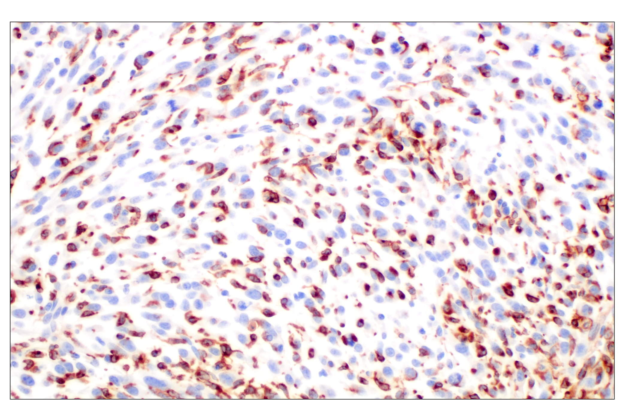 Immunohistochemistry Image 4: CD74 (F3R3L) Rabbit mAb