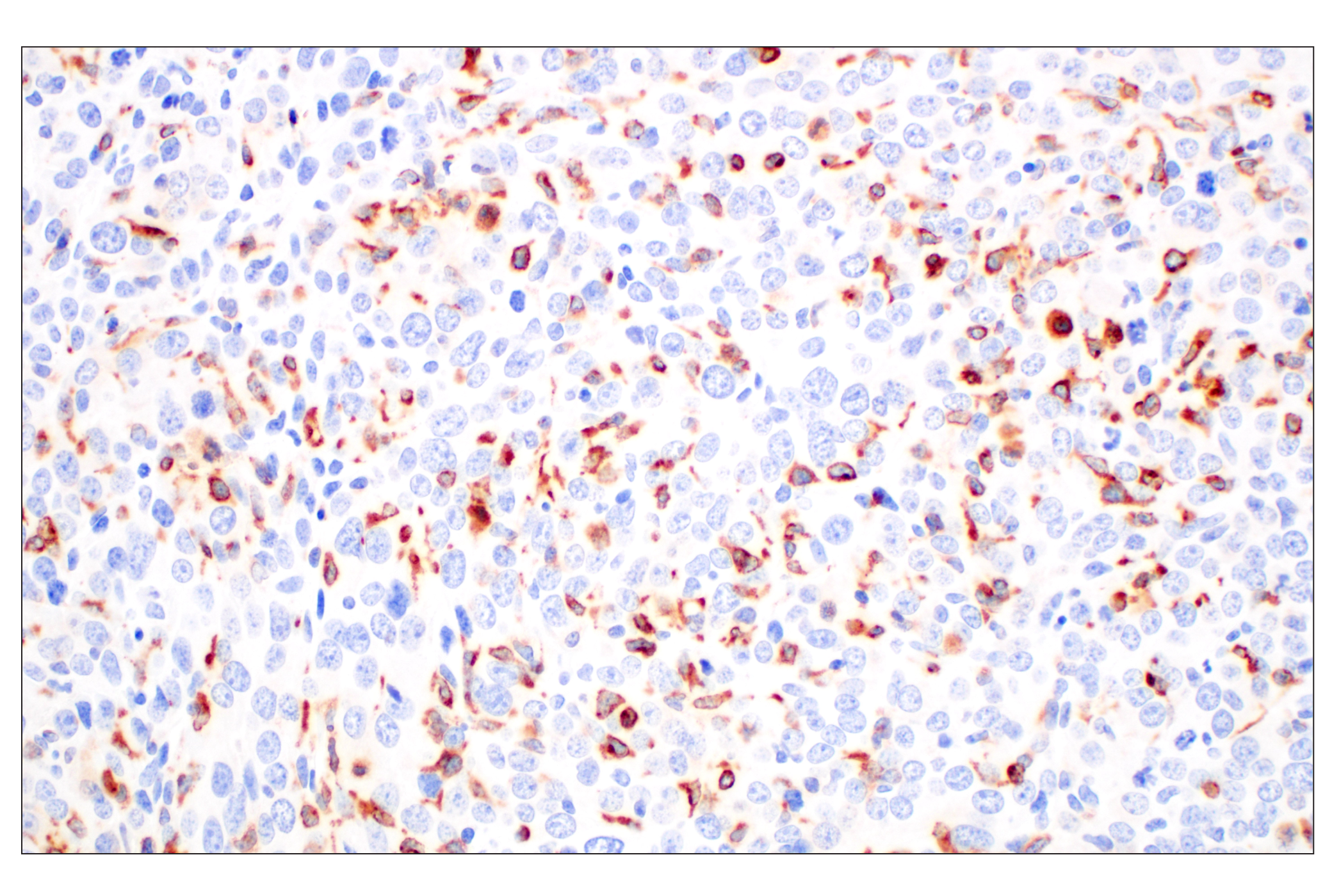 Immunohistochemistry Image 3: CD74 (F3R3L) Rabbit mAb