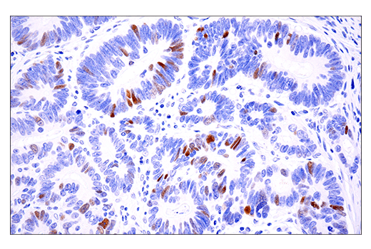 Immunohistochemistry Image 2: Phospho-Chk2 (Thr68) (E8Q1A) Rabbit mAb