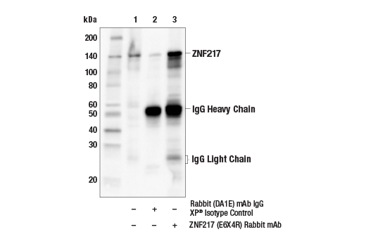 Immunoprecipitation Image 1: ZNF217 (E6X4R) Rabbit mAb