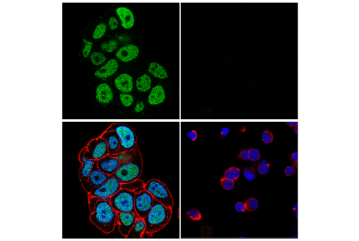 Immunofluorescence Image 1: ZNF217 (E6X4R) Rabbit mAb