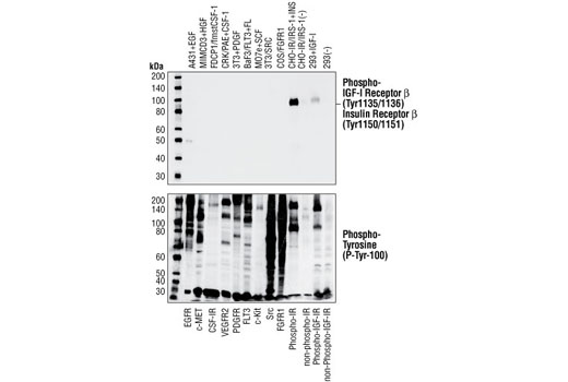 Western Blotting Image 2: Phospho-IGF-I Receptor β (Tyr1135/1136)/Insulin Receptor β (Tyr1150/1151) (19H7) Rabbit mAb (BSA and Azide Free)
