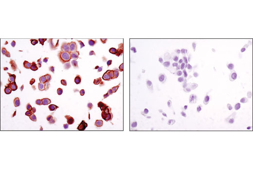 Immunohistochemistry Image 4: Annexin A2 (D11G2) Rabbit mAb