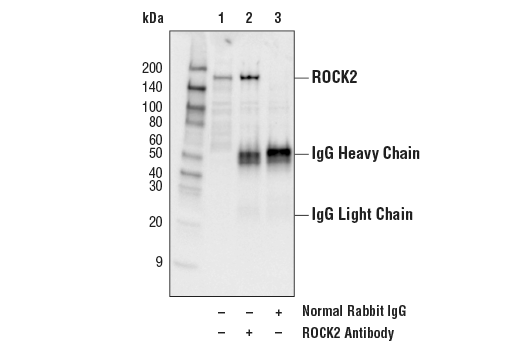 Immunoprecipitation Image 1: ROCK2 Antibody