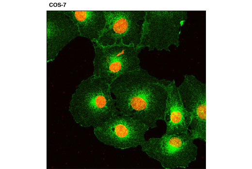 Immunofluorescence Image 1: NCS1 (D12D2) XP® Rabbit mAb