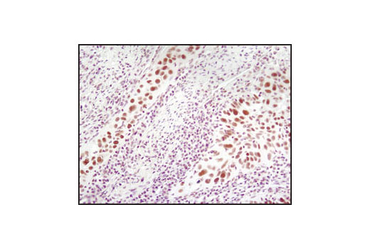 Immunohistochemistry Image 2: LSD1 (C69G12) Rabbit mAb (BSA and Azide Free)