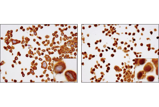 Immunohistochemistry Image 1: NF-κB p65 (D14E12) XP® Rabbit mAb