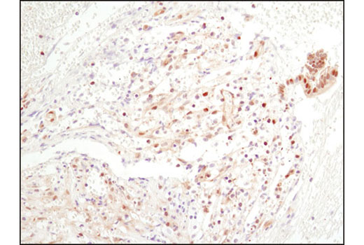 Immunohistochemistry Image 2: NF-κB p65 (D14E12) XP® Rabbit mAb