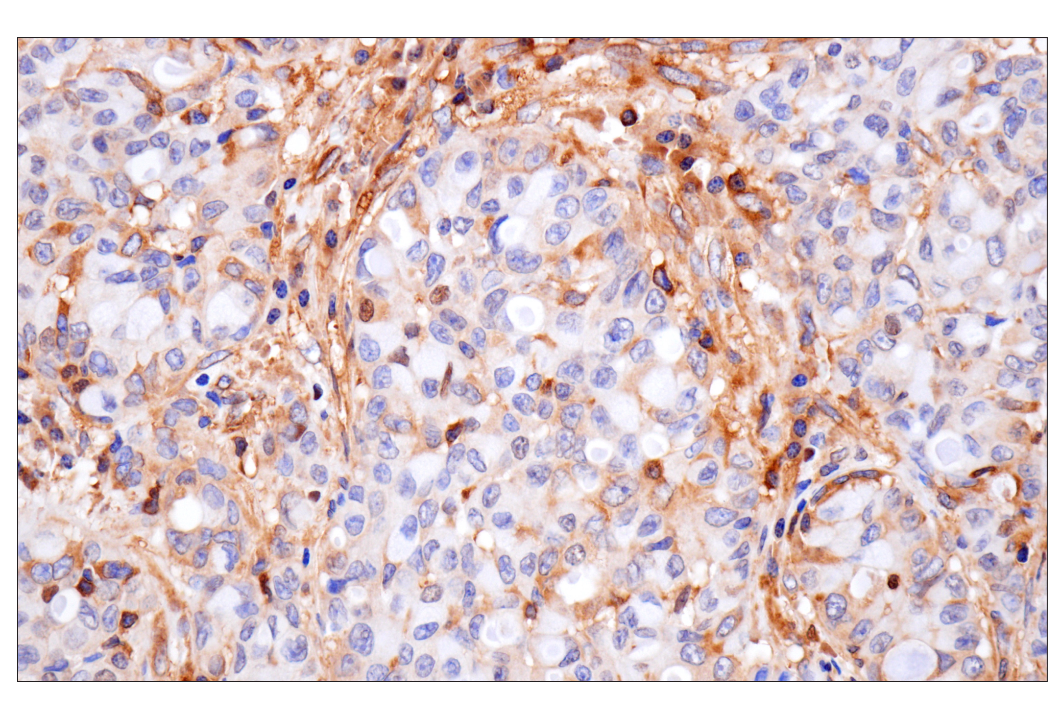 Immunohistochemistry Image 5: NF-kappaB p65 (D14E12) Rabbit Monoclonal Antibody