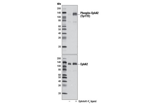 Western Blotting Image 1: Phospho-EphA2 (Tyr772) Antibody