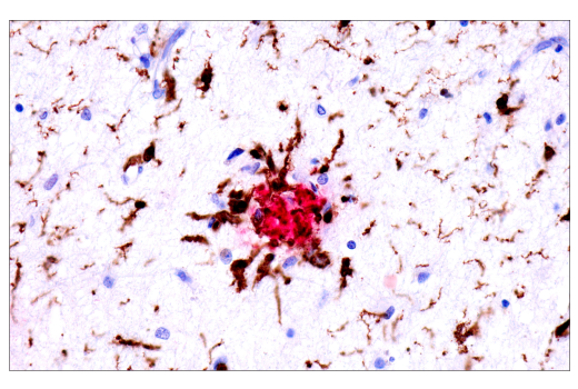 Immunohistochemistry Image 1: SignalStain® IHC Dual Staining Kit (HRP, Rabbit, Brown / AP, Mouse, Red)