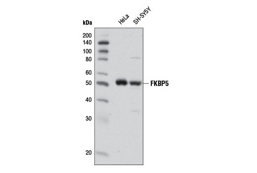 Western Blotting Image 1: FKBP5 Antibody