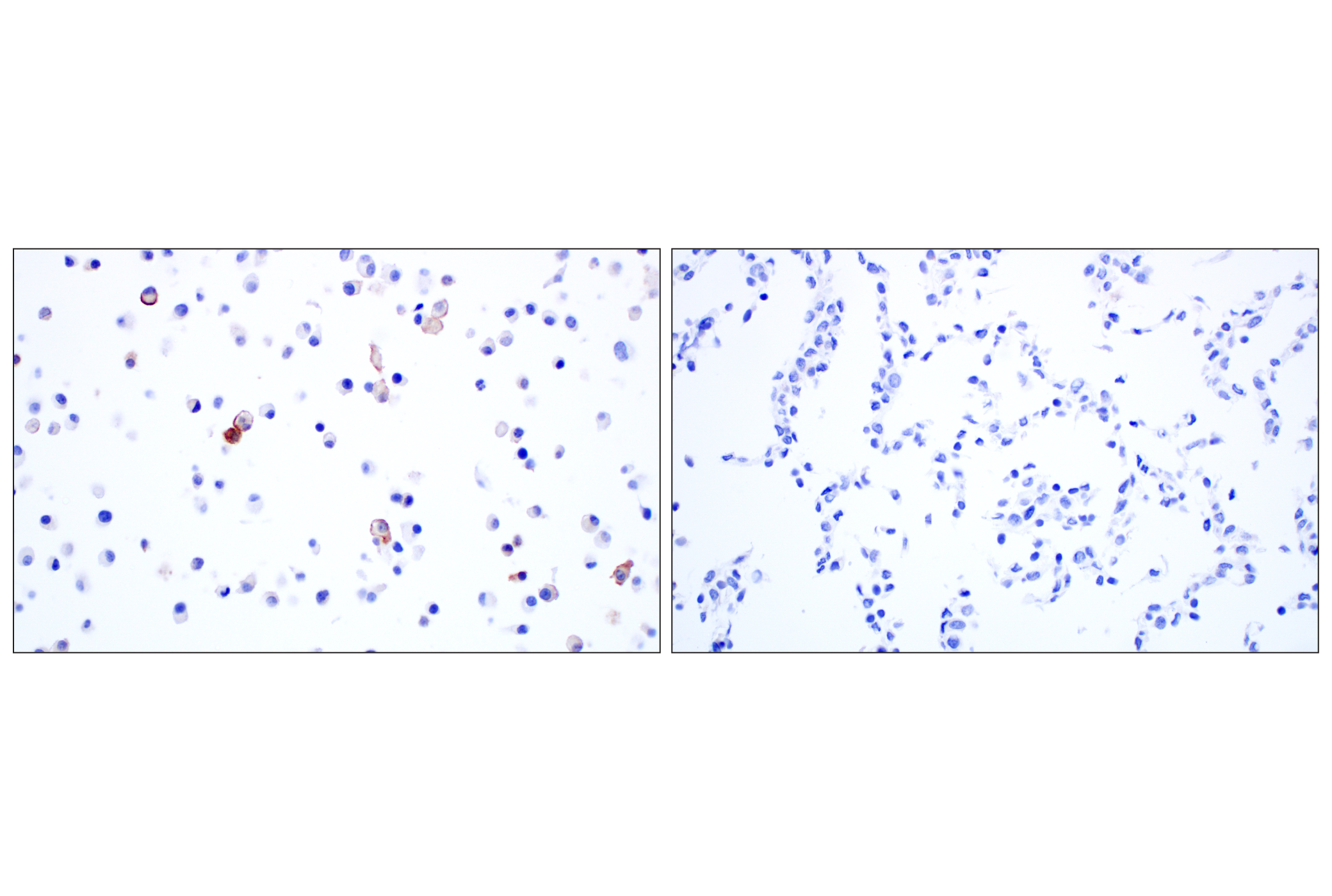 Immunohistochemistry Image 9: Siglec-1/CD169 (E1D7G) Rabbit mAb