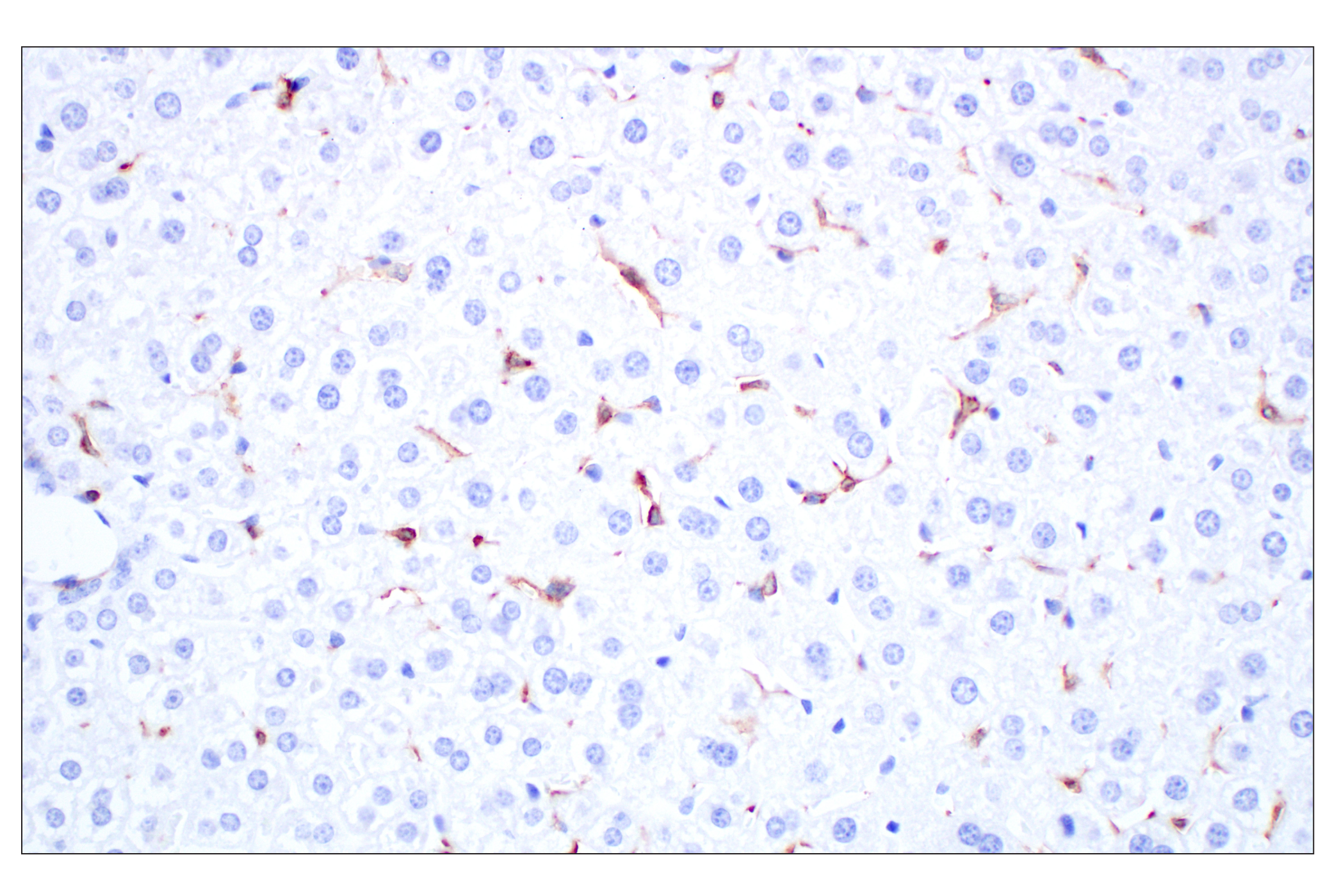 Immunohistochemistry Image 5: Siglec-1/CD169 (E1D7G) Rabbit mAb