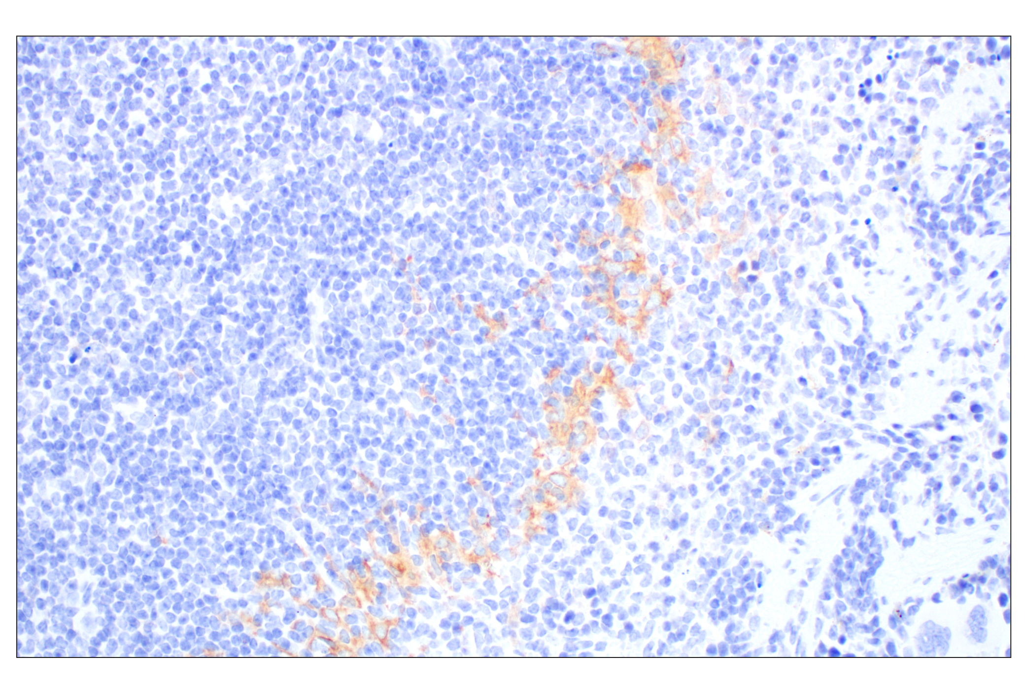 Immunohistochemistry Image 6: Siglec-1/CD169 (E1D7G) Rabbit mAb