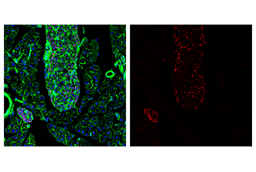 Immunofluorescence Image 2: Tox/Tox2 (E6G5O) Rabbit mAb (Alexa Fluor® 647 Conjugate)