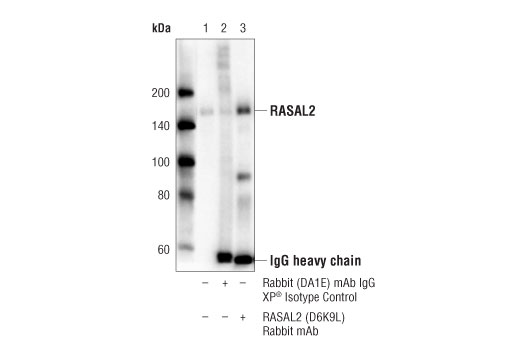 Immunoprecipitation Image 1: RASAL2 (D6K9L) Rabbit mAb