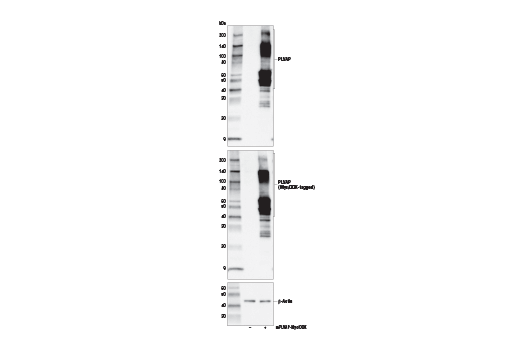 Western Blotting Image 2: PLVAP Antibody